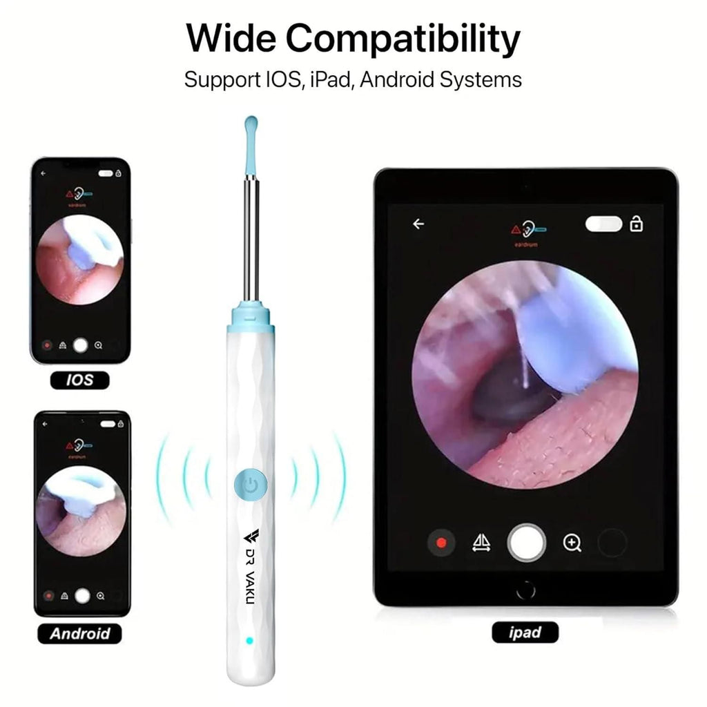 Smart Visual Ear Wax Cleaner with Camera – WiFi Otoscope Ear Cleaning Kit for Android & iOS