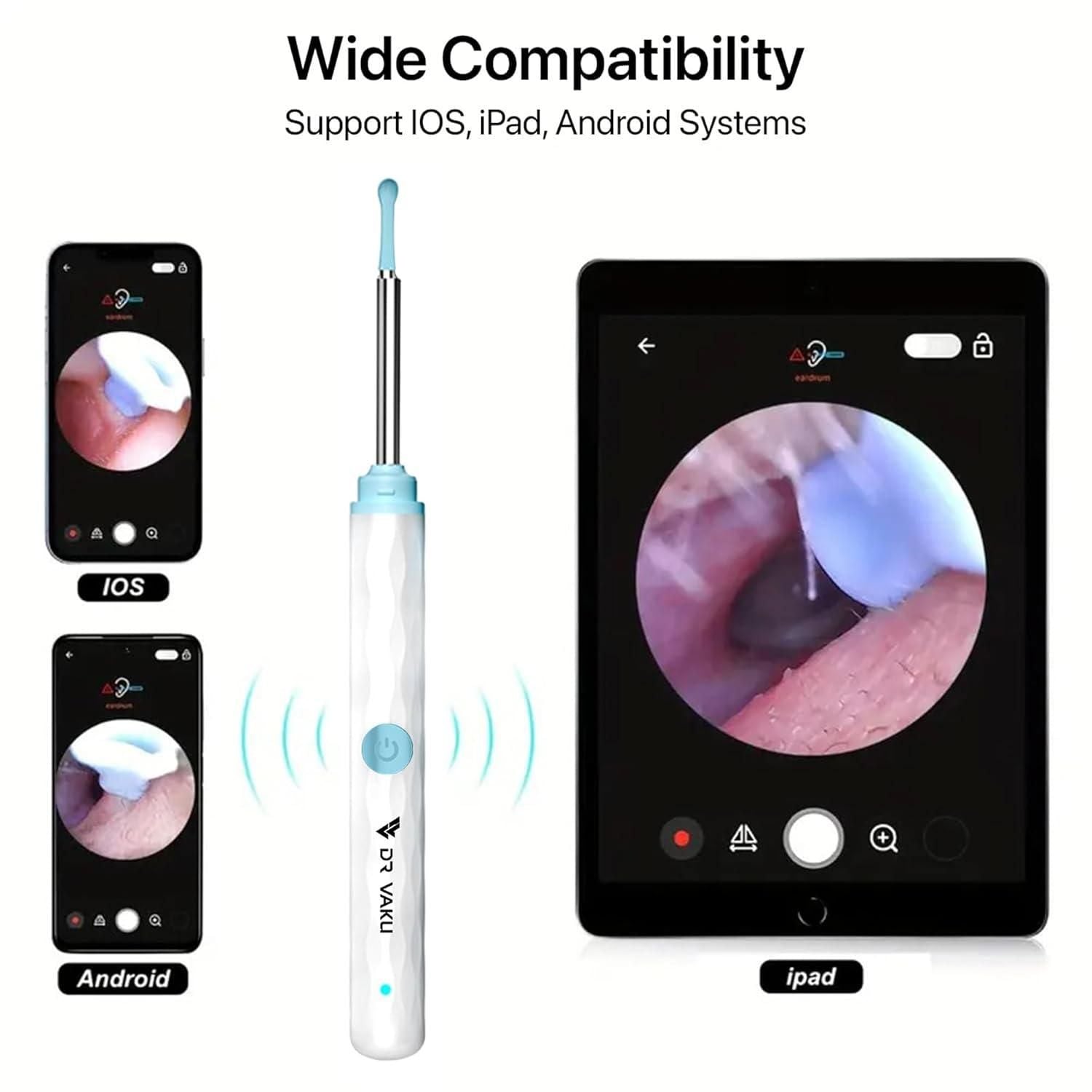 Smart Visual Ear Wax Cleaner with Camera – WiFi Otoscope Ear Cleaning Kit for Android & iOS