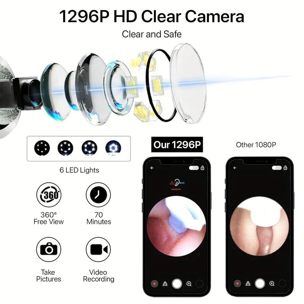 Smart Visual Ear Wax Cleaner with Camera – WiFi Otoscope Ear Cleaning Kit for Android & iOS